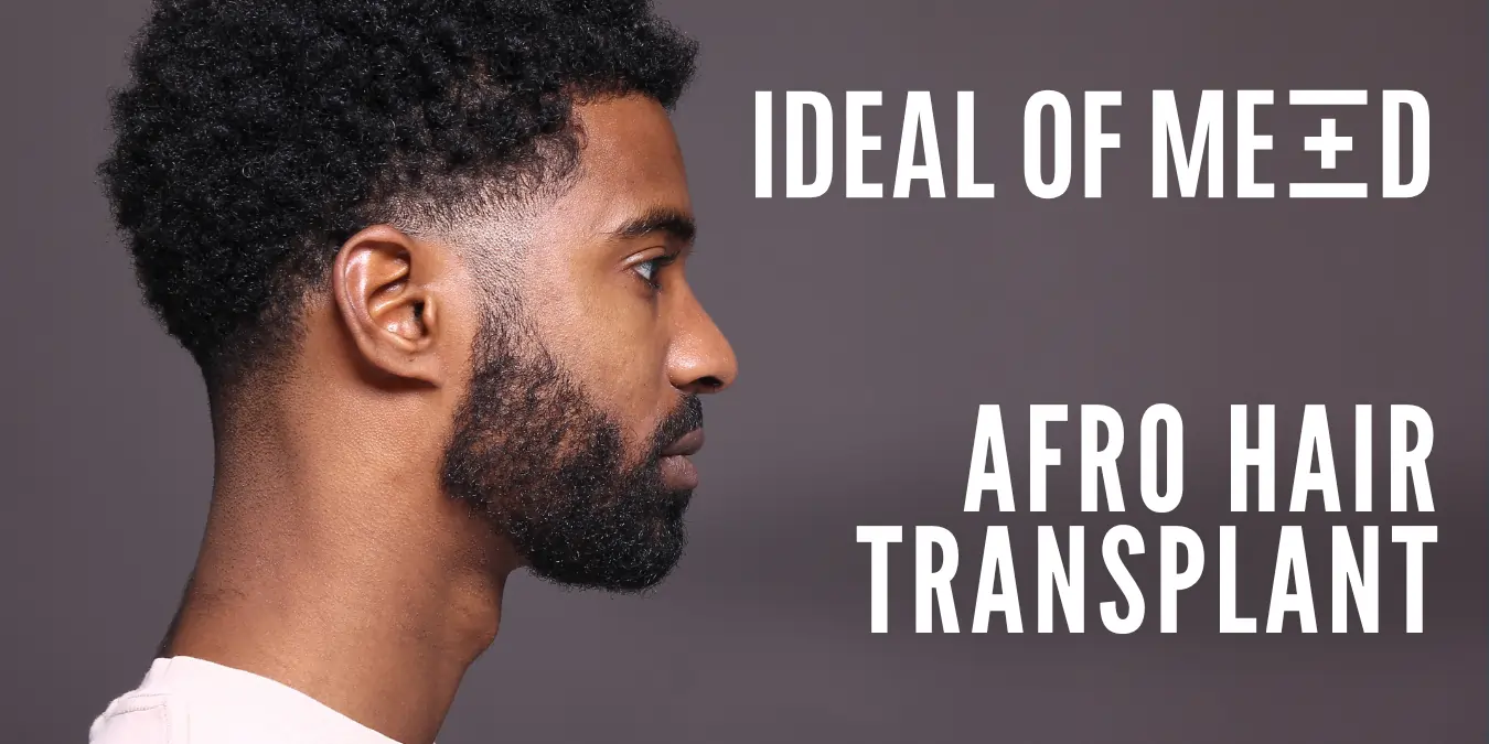 Ideal of MeD Afro Hair Transplant Before and After Pictures and Results