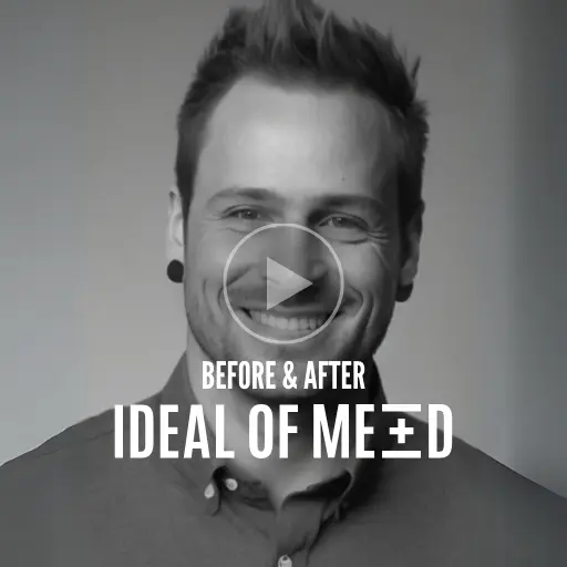 Ken's Makeover - Ideal of MeD
