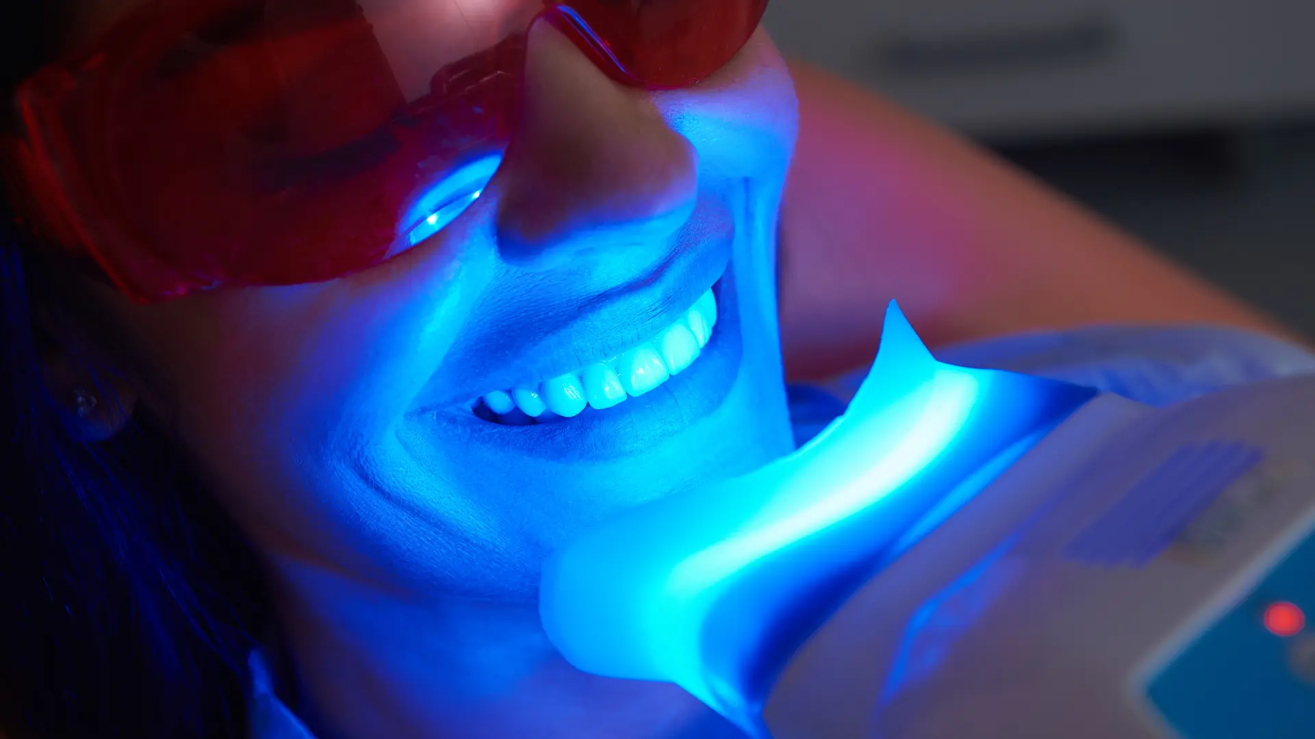 teeth whitening hack