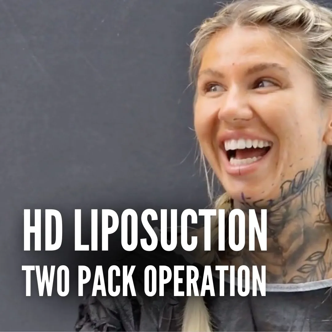 HD Liposuction