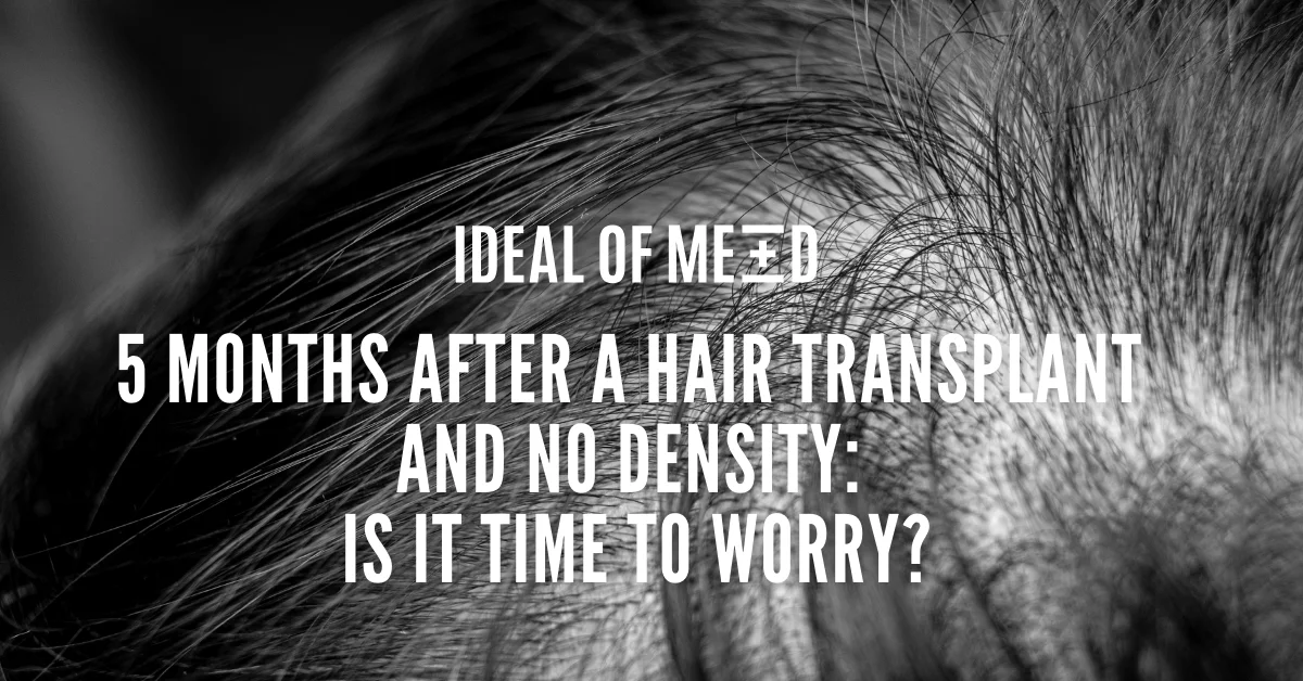 5 months after a hair transplant and no density