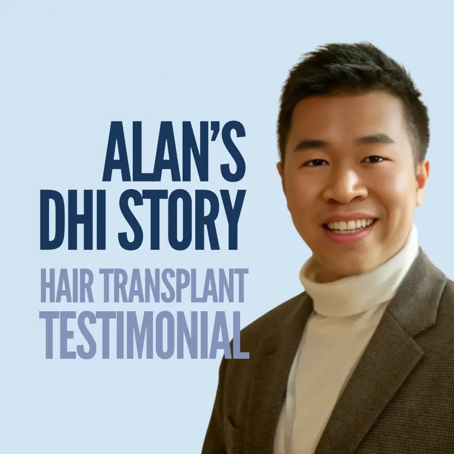 Alan DHI 4100 grafts hair transplant testimonial