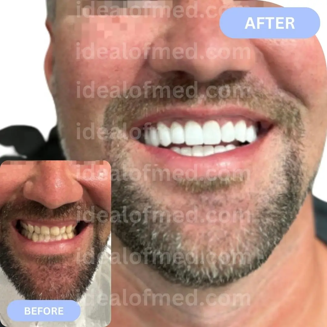 Dental Results
