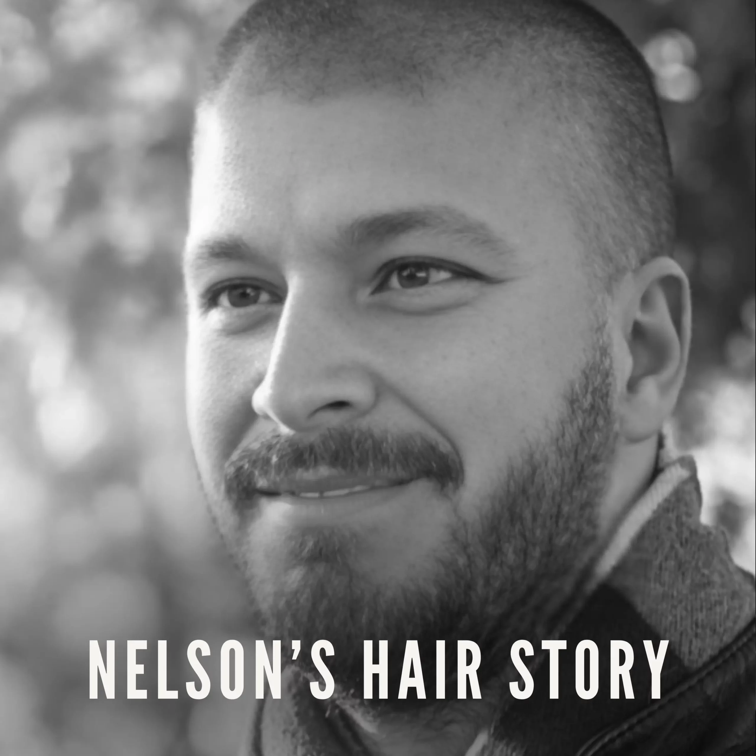 FUE Hair Transplant Turkey Nelsons Incredible Istanbul Experience Testimonials Page