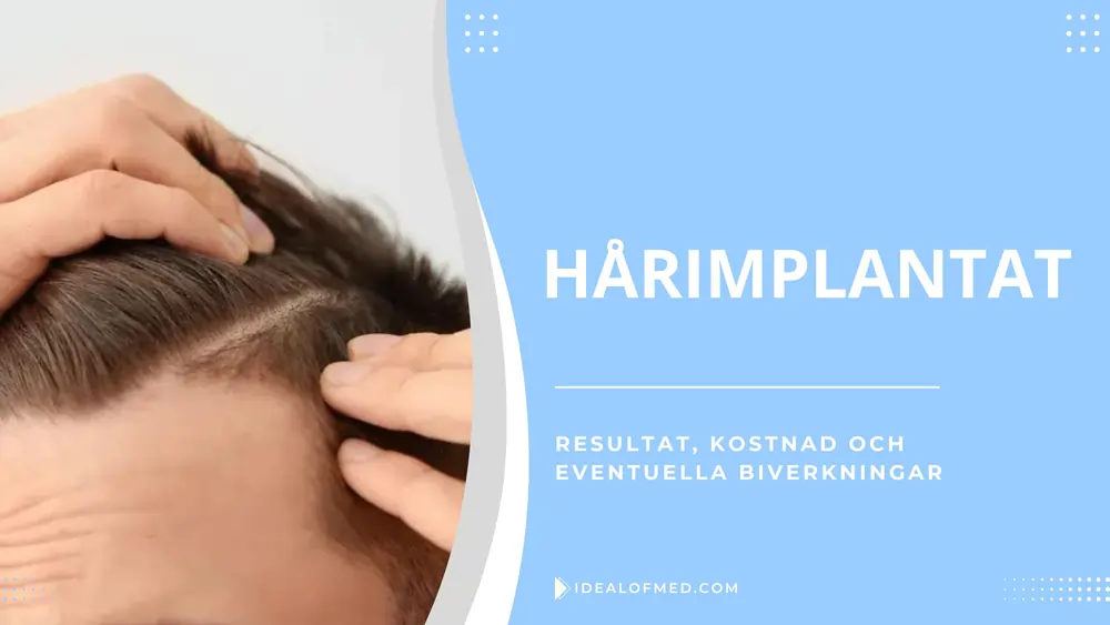 Hårimplantat Guide