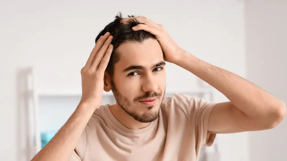 Hårtransplantation på ärr