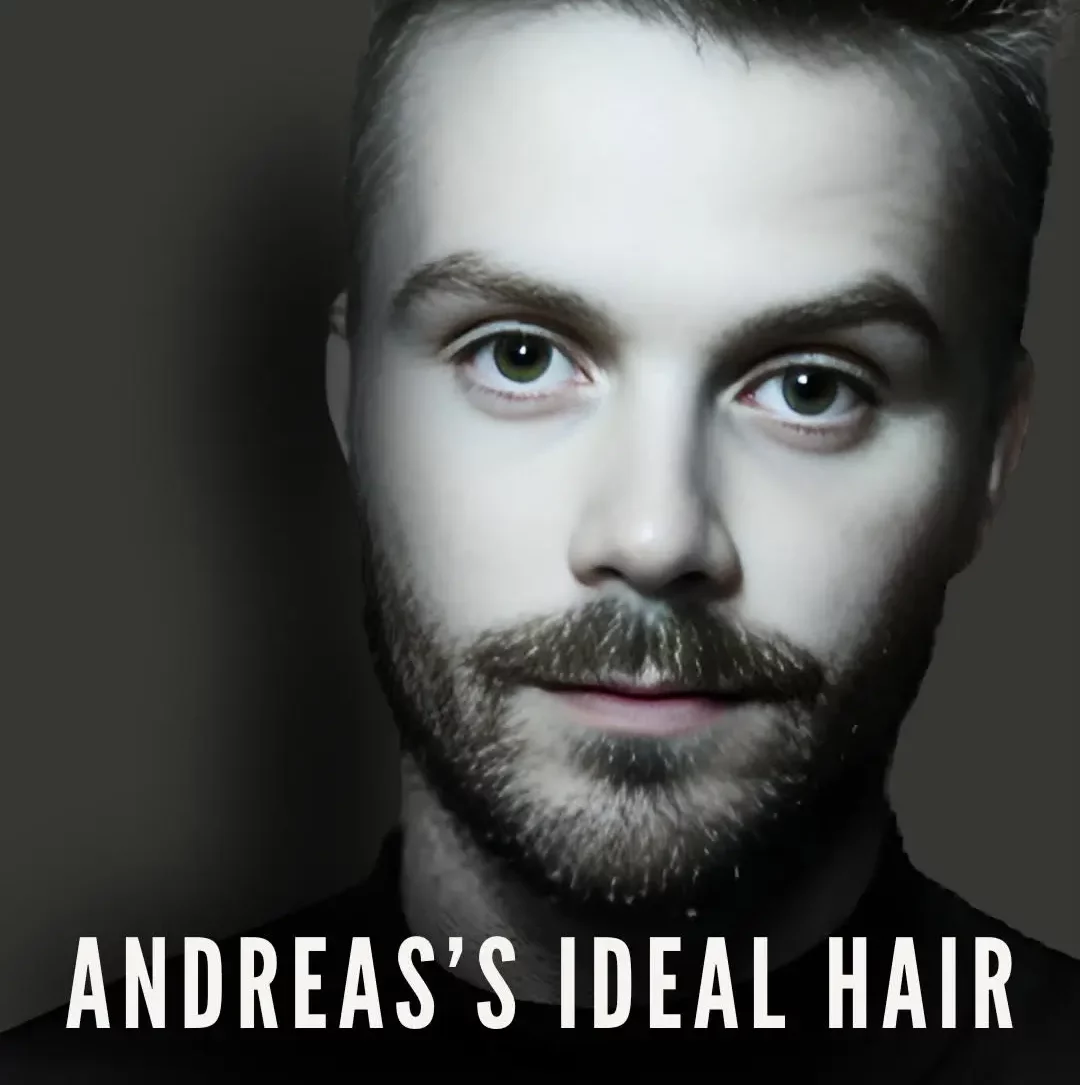 Holiday Hair Transplant Testimonial Andreas from Norway
