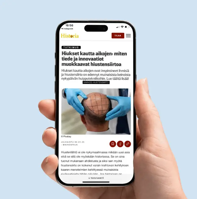 Ideal of MeD Featured on Historianet.fi | Hair Transplant Innovations