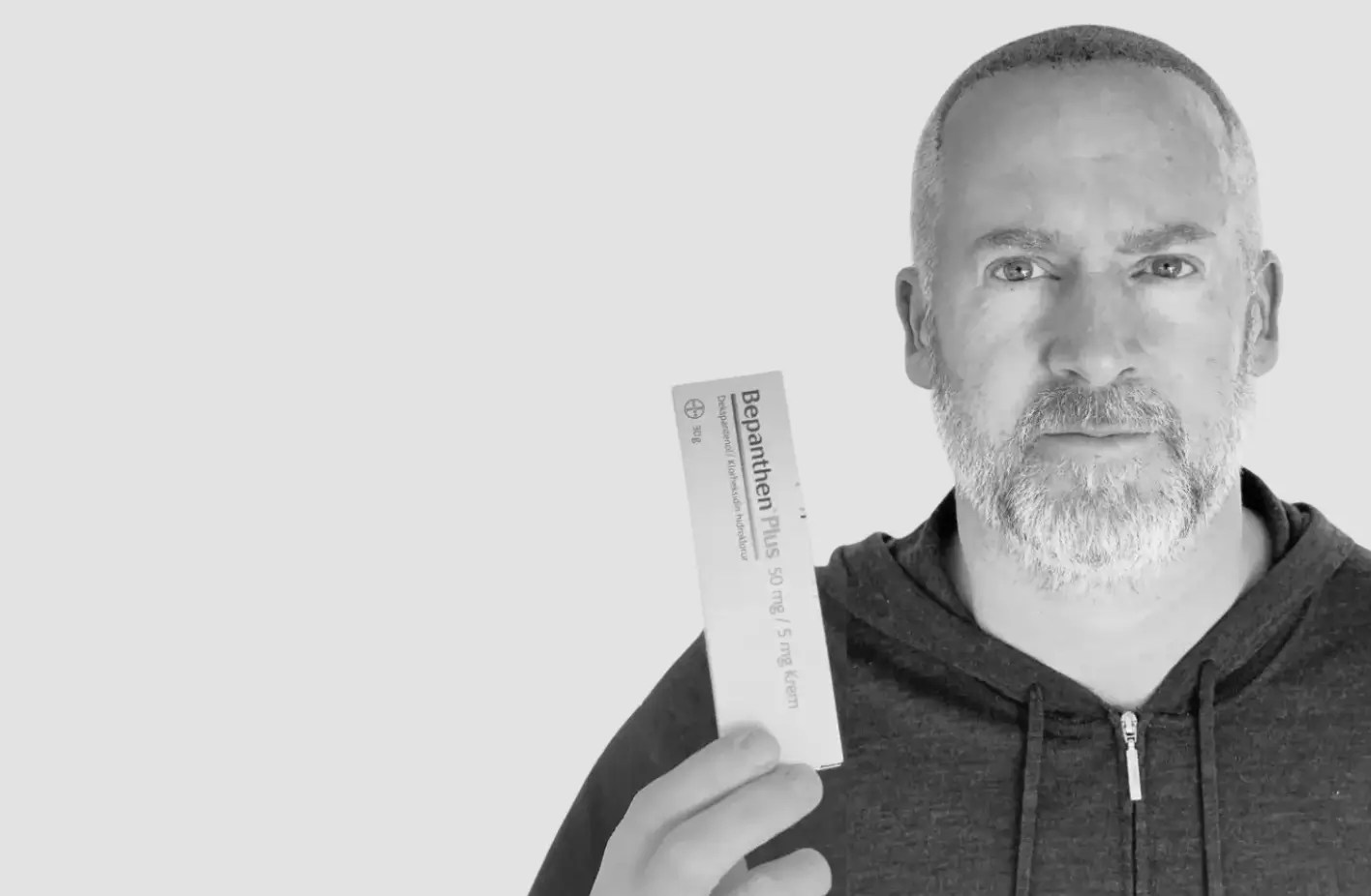 How to Prevent and Treat Itching After a Hair Transplant