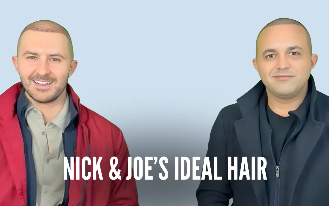 Joe Nick 5500 Grafts Hair Transplant Ideal of MeD Testimonials