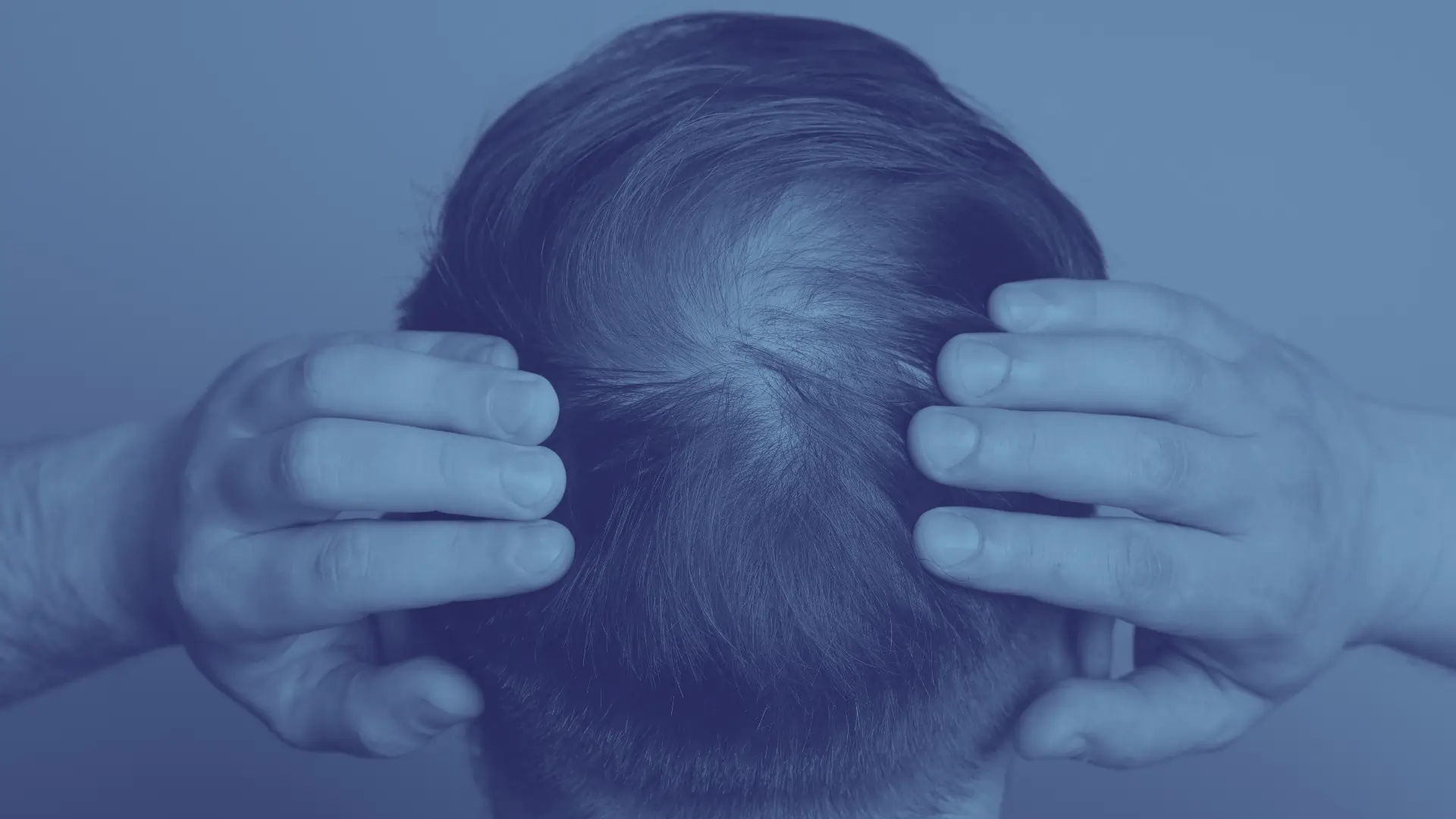 Norwood Scale for Hair Loss: Stages 1-7 Explained | Ideal of MeD