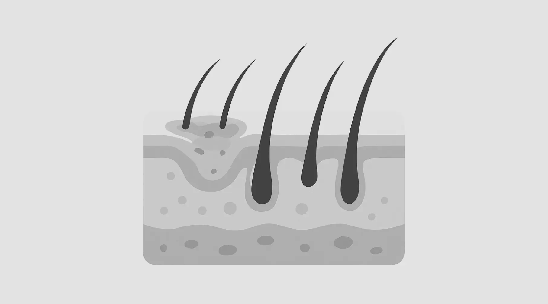 Skin conditions and hair transplants a comprehensive guide by IdealofMed Turkiye