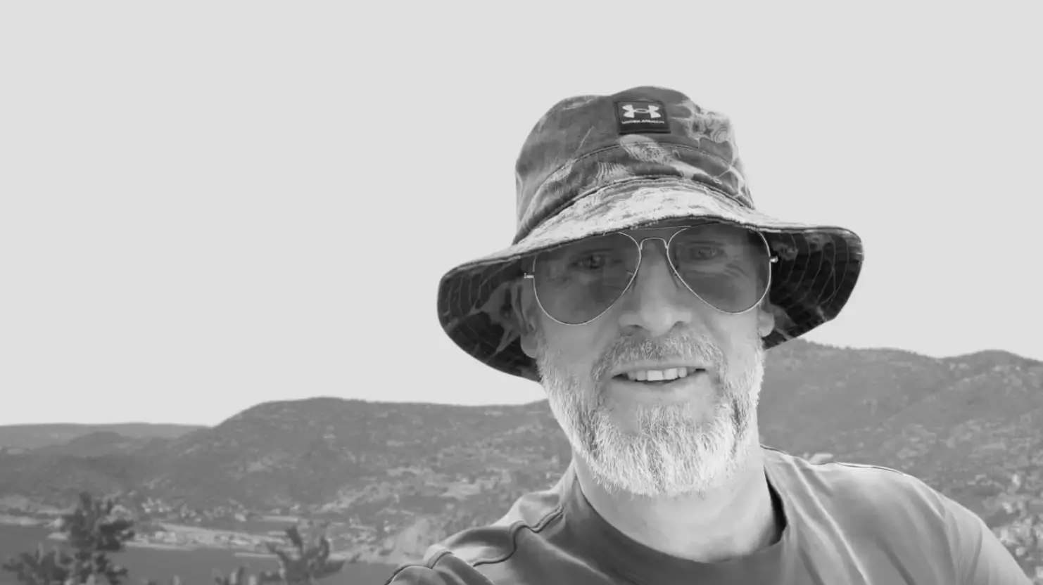 Sun Exposure After a Hair Transplant