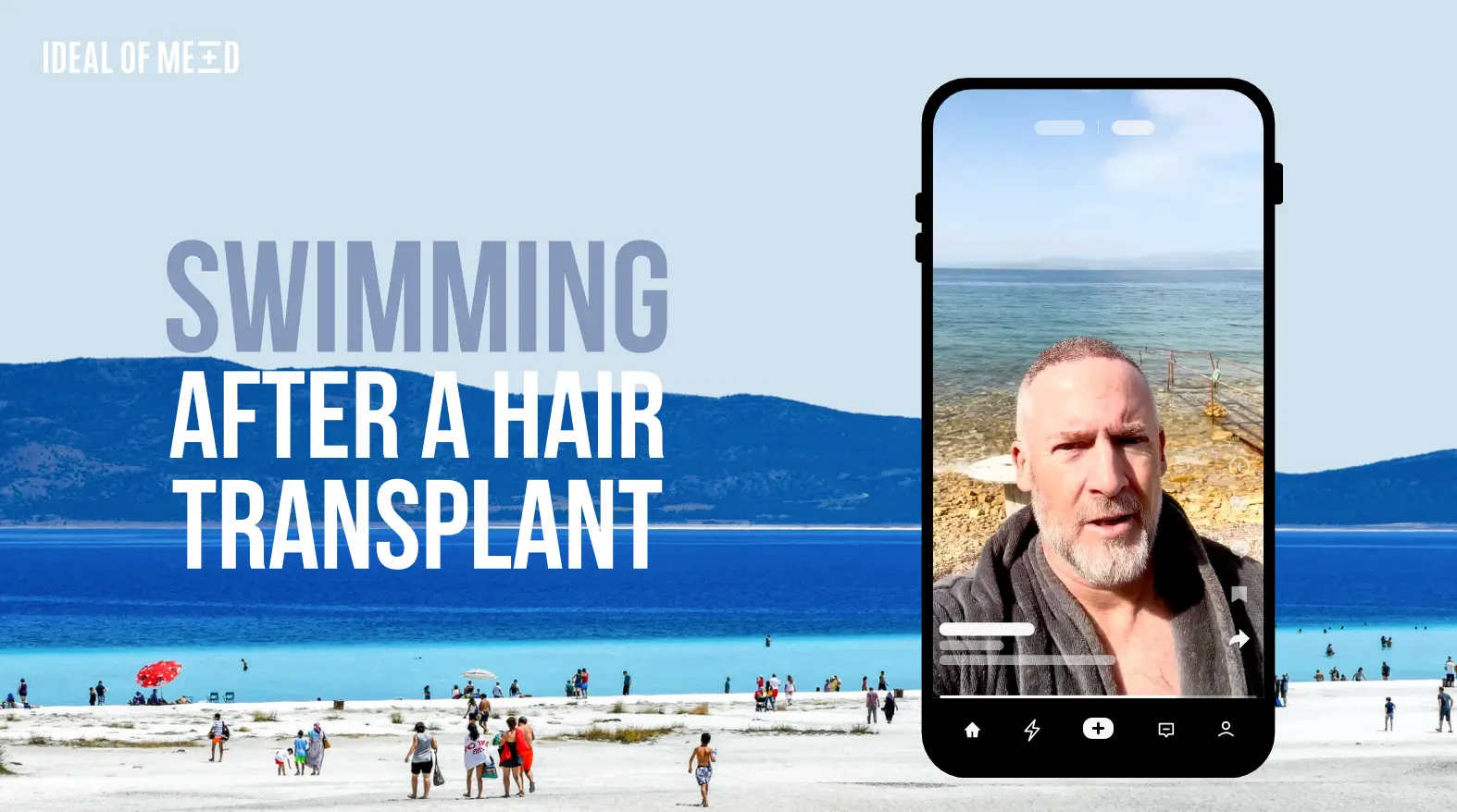 Swimming after hair transplant