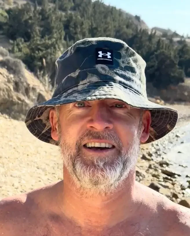 Cem, 20 days post-hair transplant, keeping his grafts protected at the beach. Watch his video as he shares five key reasons why wearing a hat is essential for healthy hair growth.