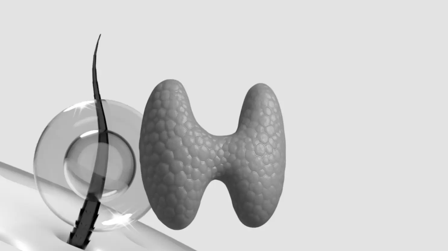 Hair Transplants for Thyroid-Related Hair Loss: What You Need to Know