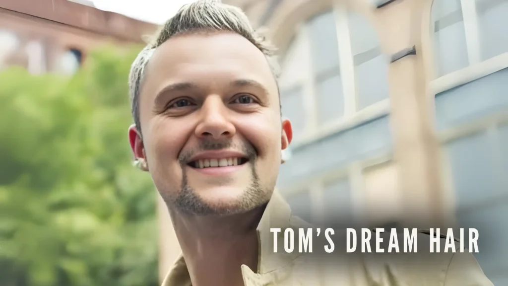 Tom DHI 3000 grafts hair transplant cover