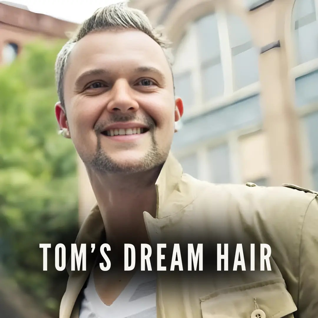 Tom DHI Testimonial 3000 Grafts Hair Transplant
