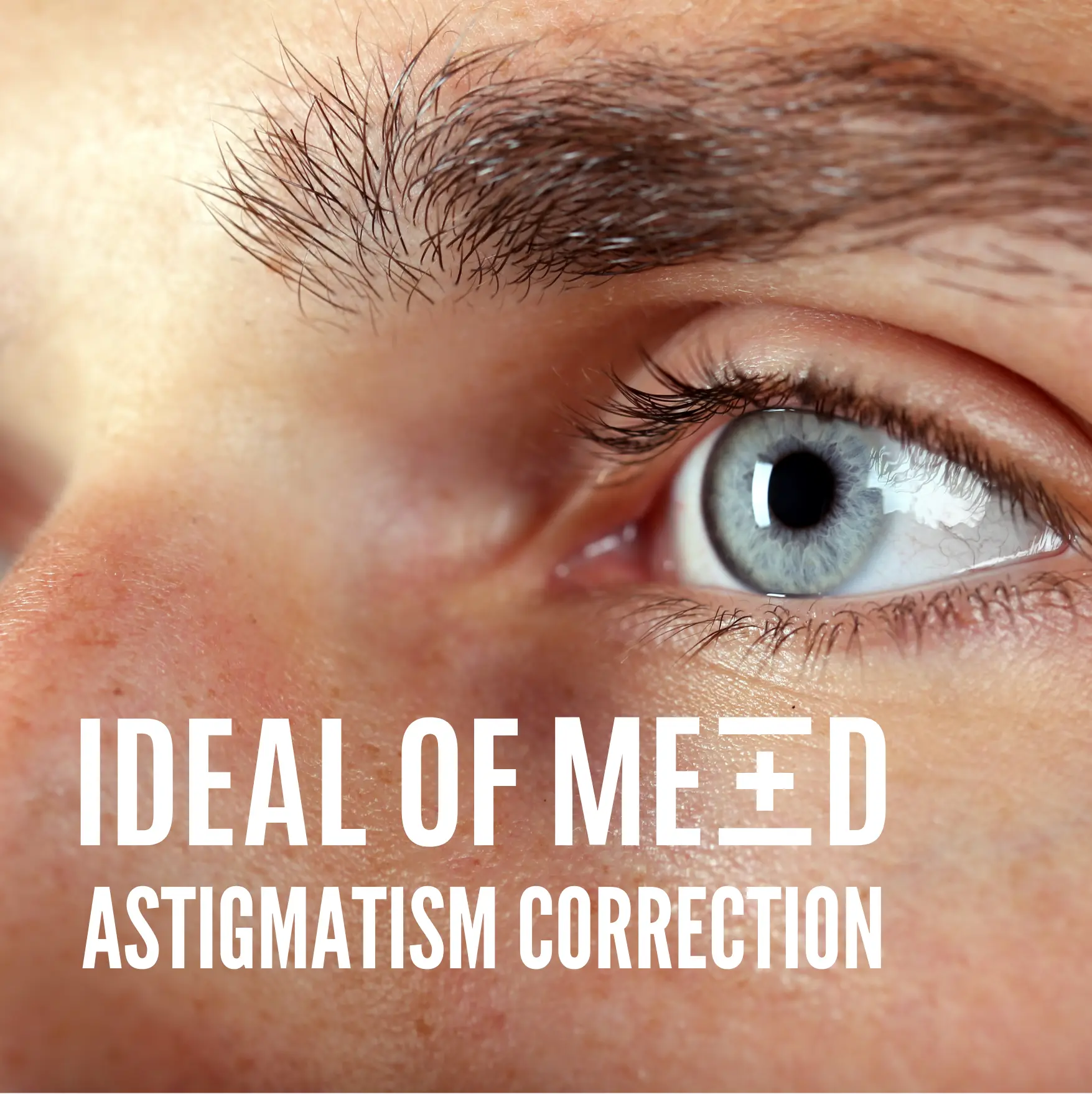 can lasik fix astigmatism