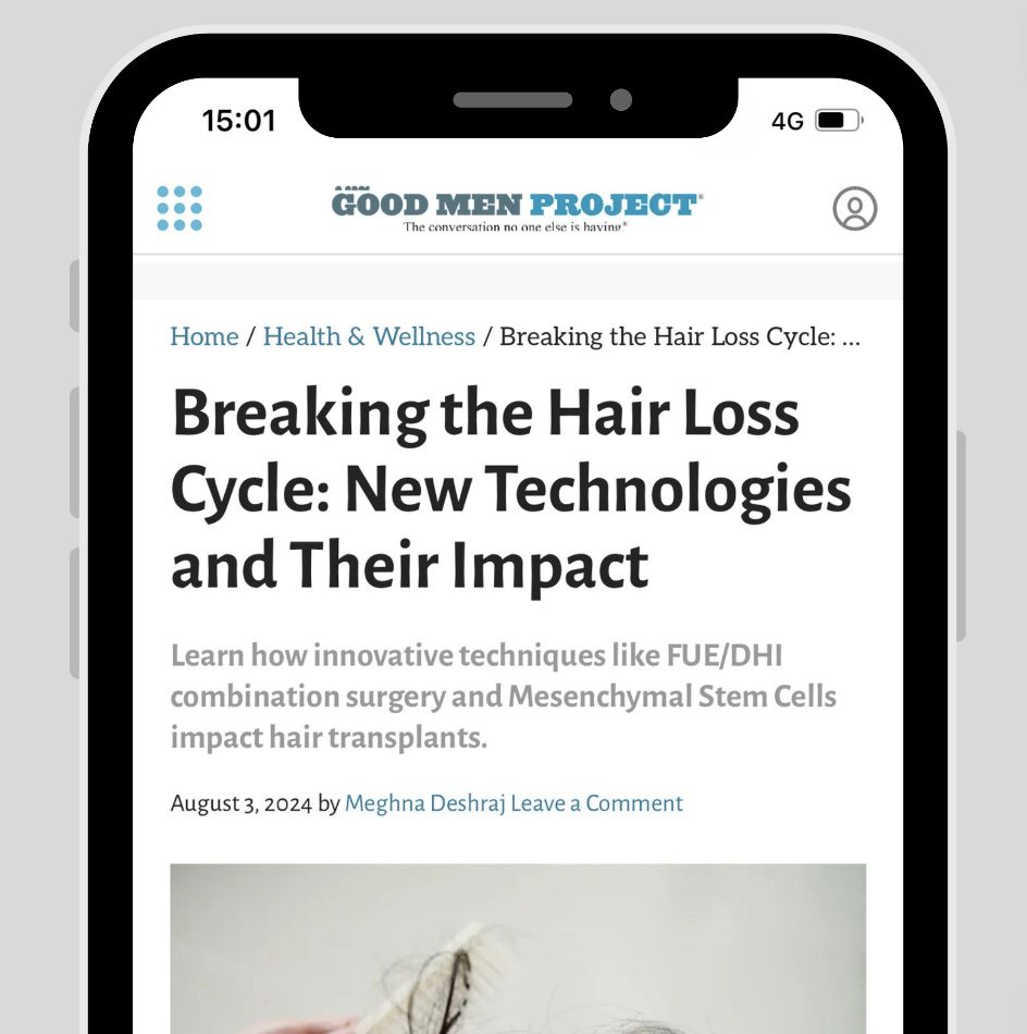 hair transplant article
