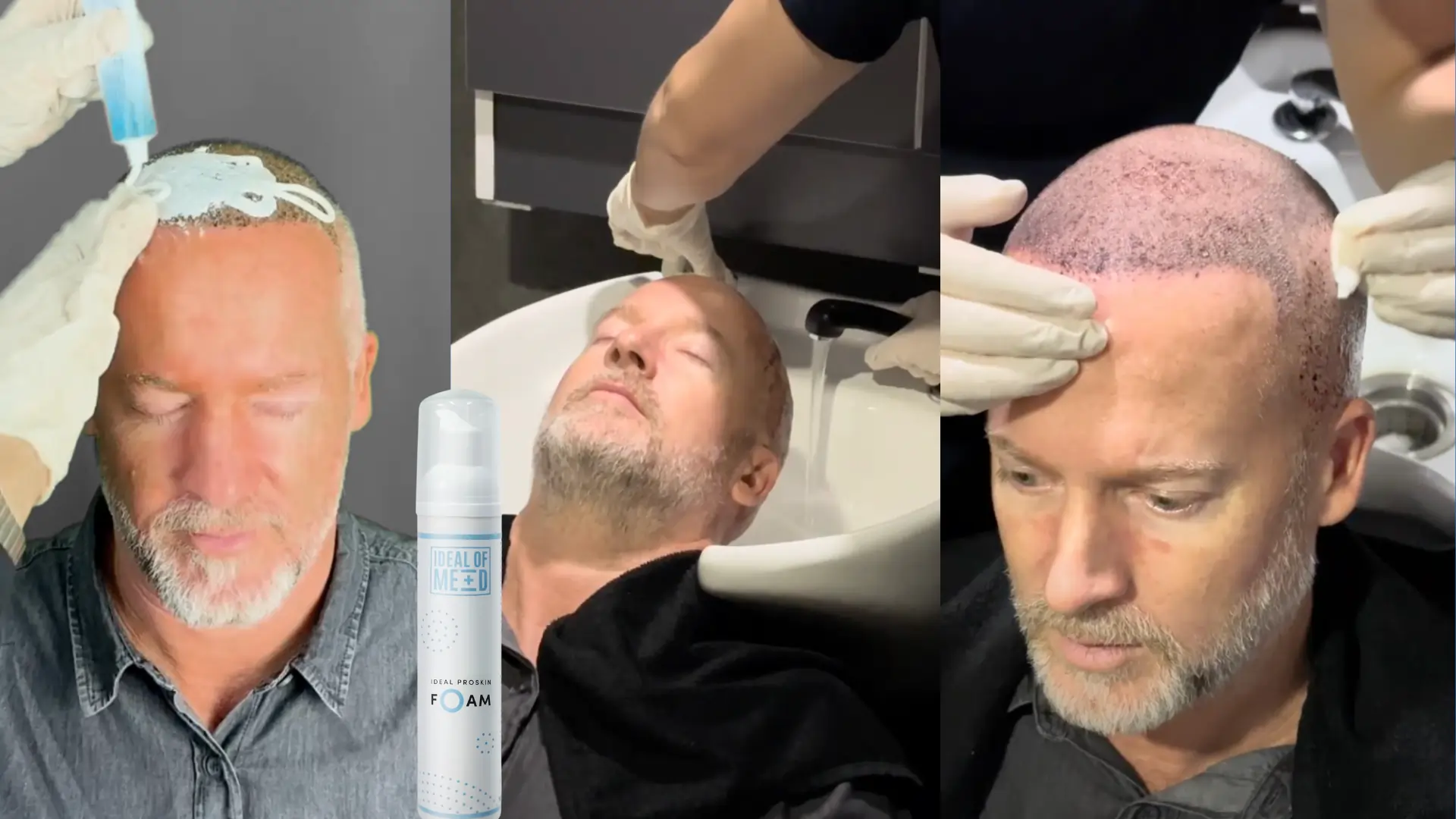 scab removal