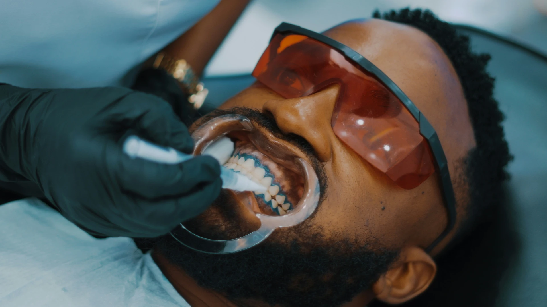 8 Signs That You Need Dental Implants
