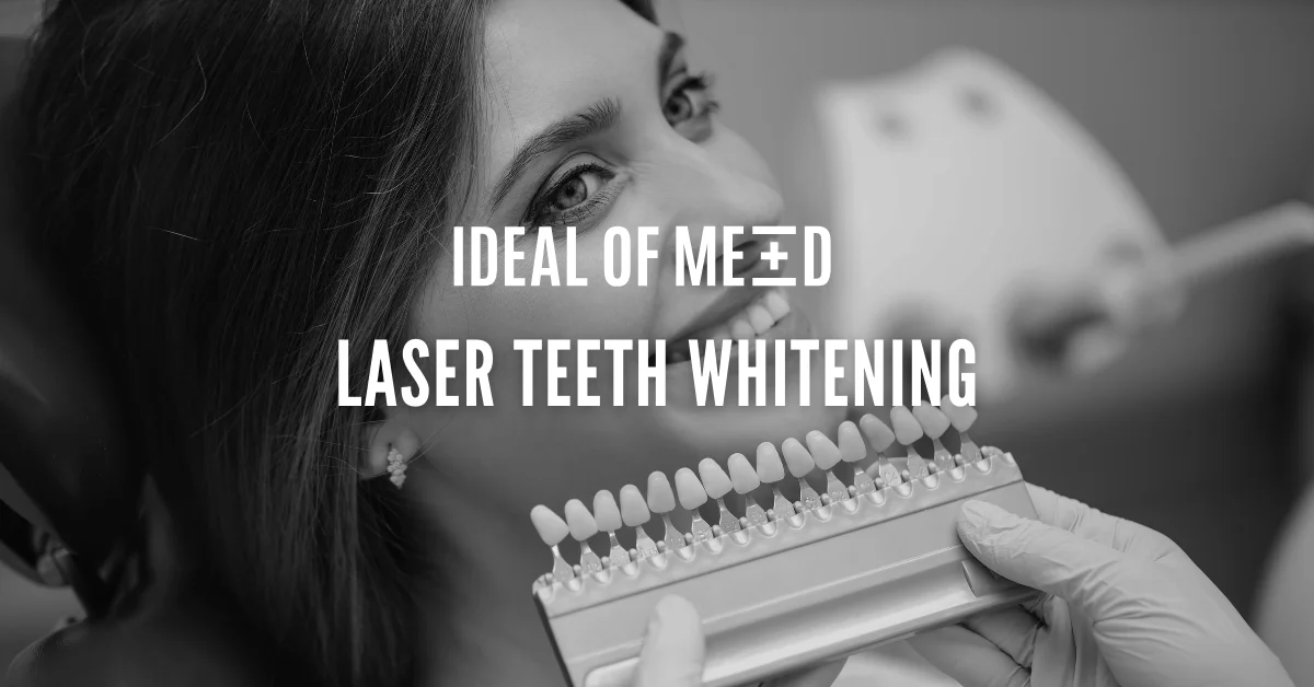 laser teeth whitening