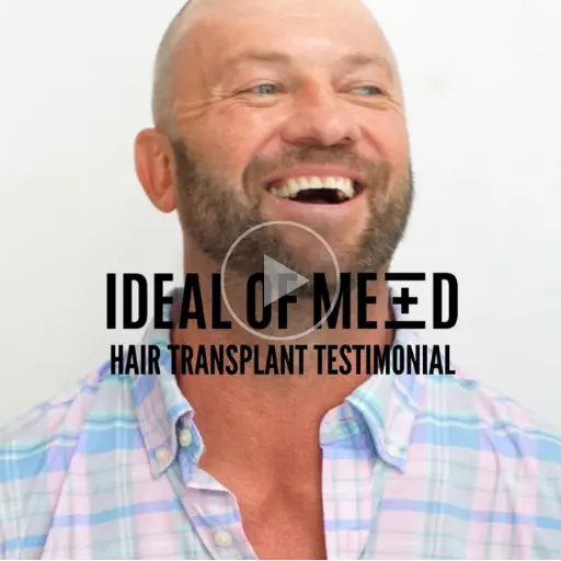 The Ideal Dream - Jason's Hair Transplant