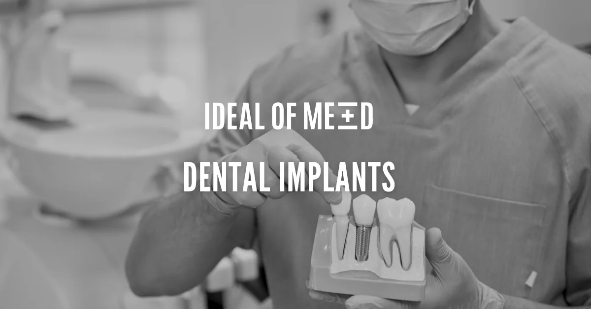 DENTAL IMPLANTS