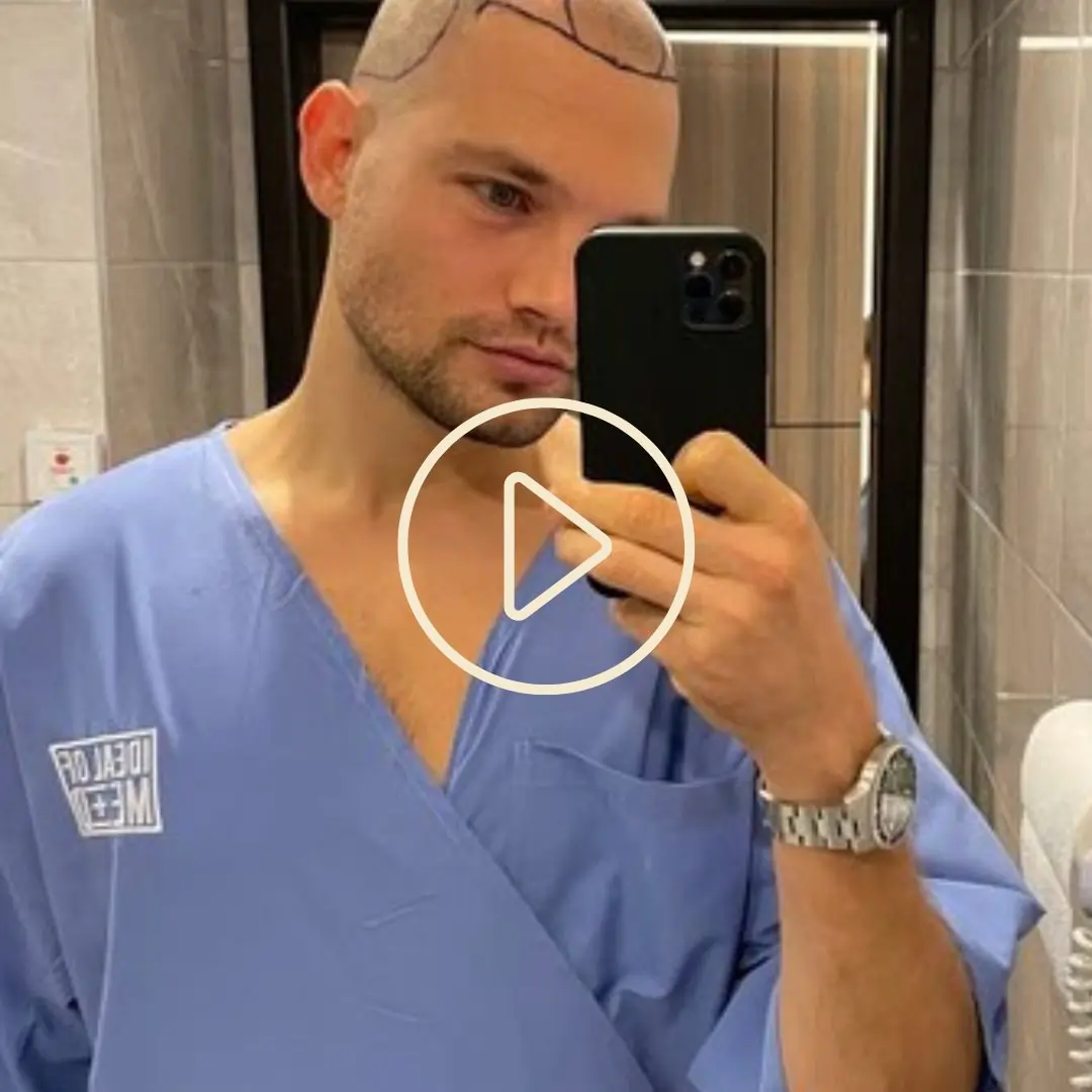 Copie de Hairtransplantation BeforeAfter + Testimonials(12)