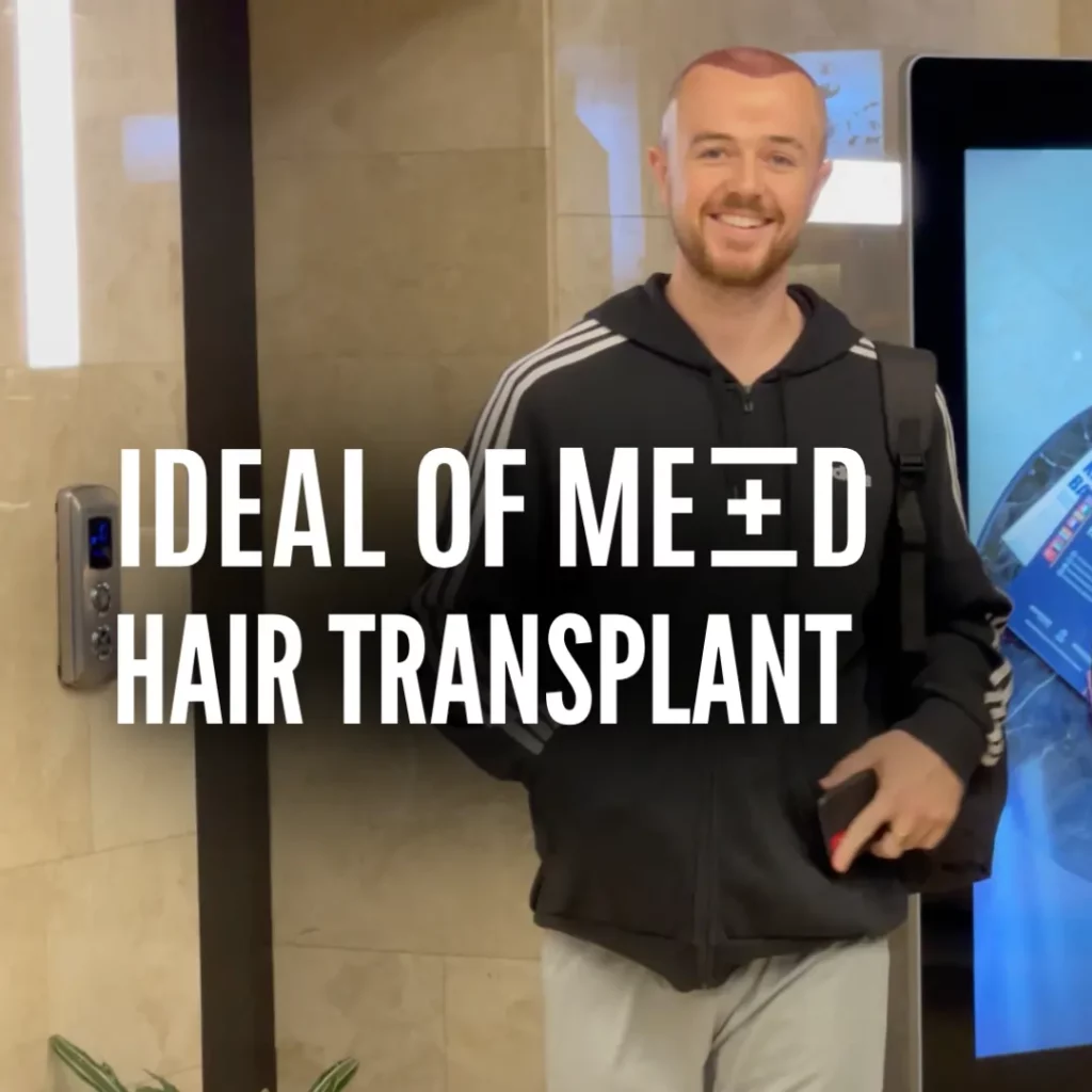 Dylan's DHI hair transplant testimonial