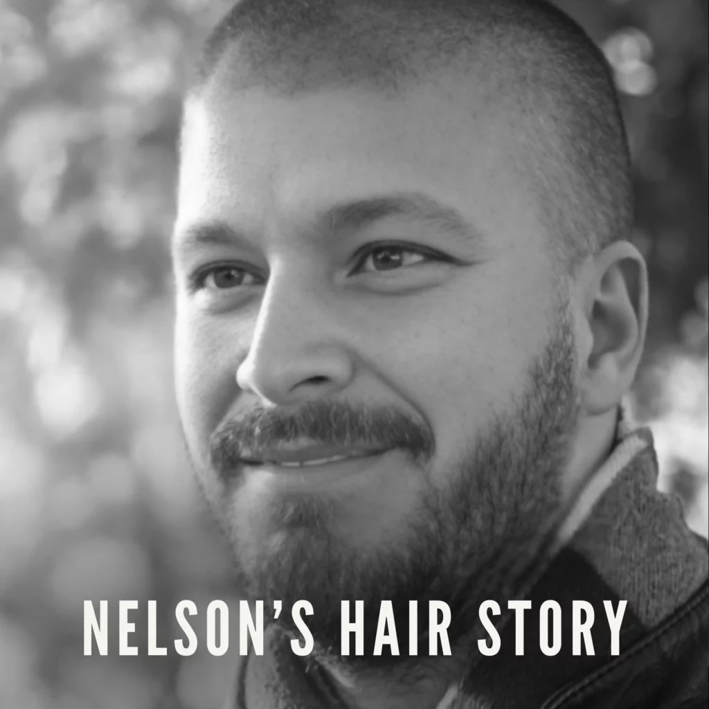 FUE Hair Transplant Turkey Nelsons Incredible Istanbul Experience Testimonials Page