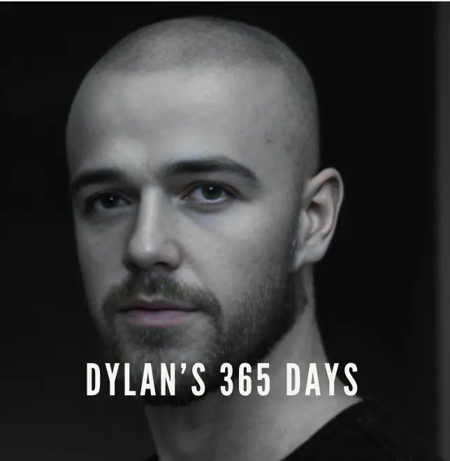 Hair Transplant After 1 Year: Dylan's Transformation with IdealofMeD