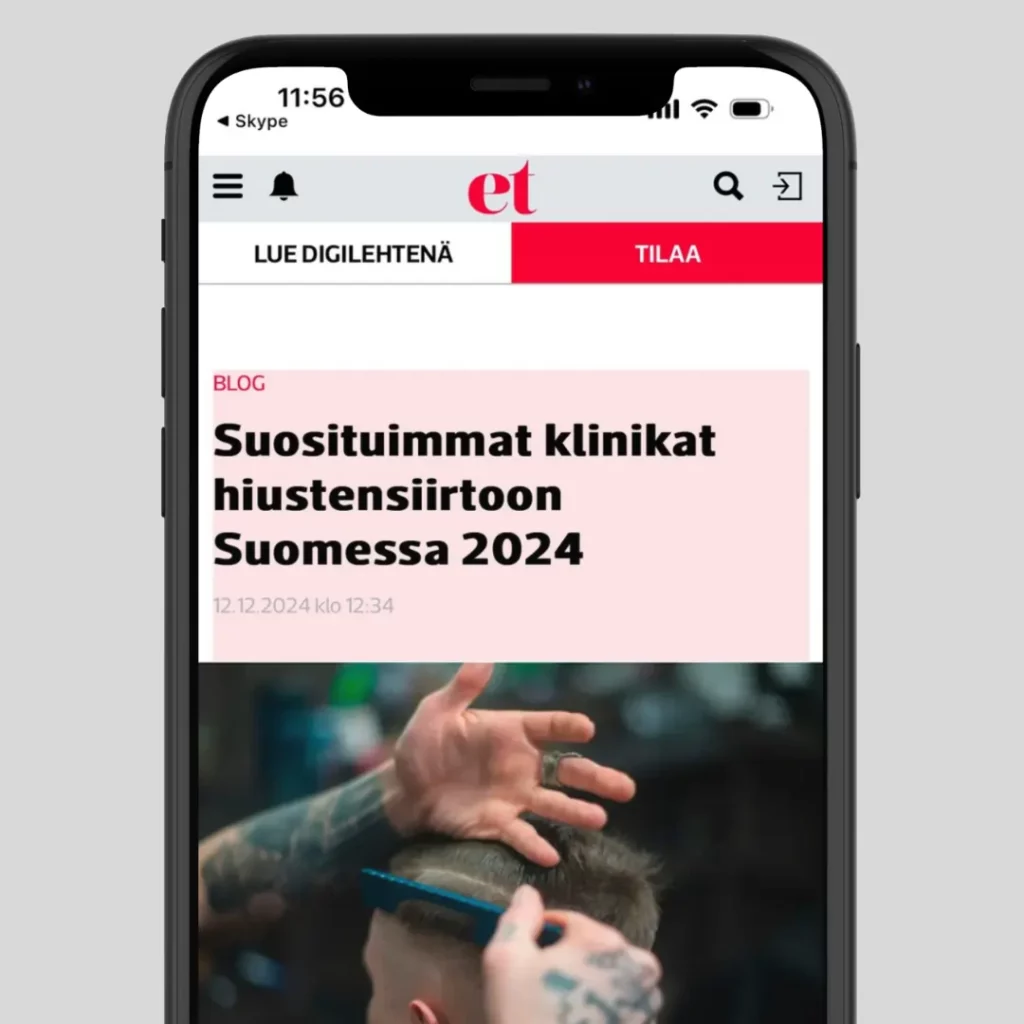 IdealofMeD Ranked #1 Hair Transplant Clinic in Finland by Etlehti.fi