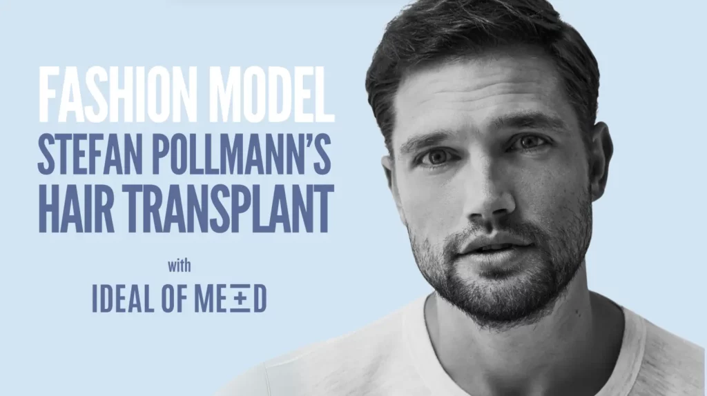 Model Stefan Pollman hair transplant idealofmed best Turkey 2025