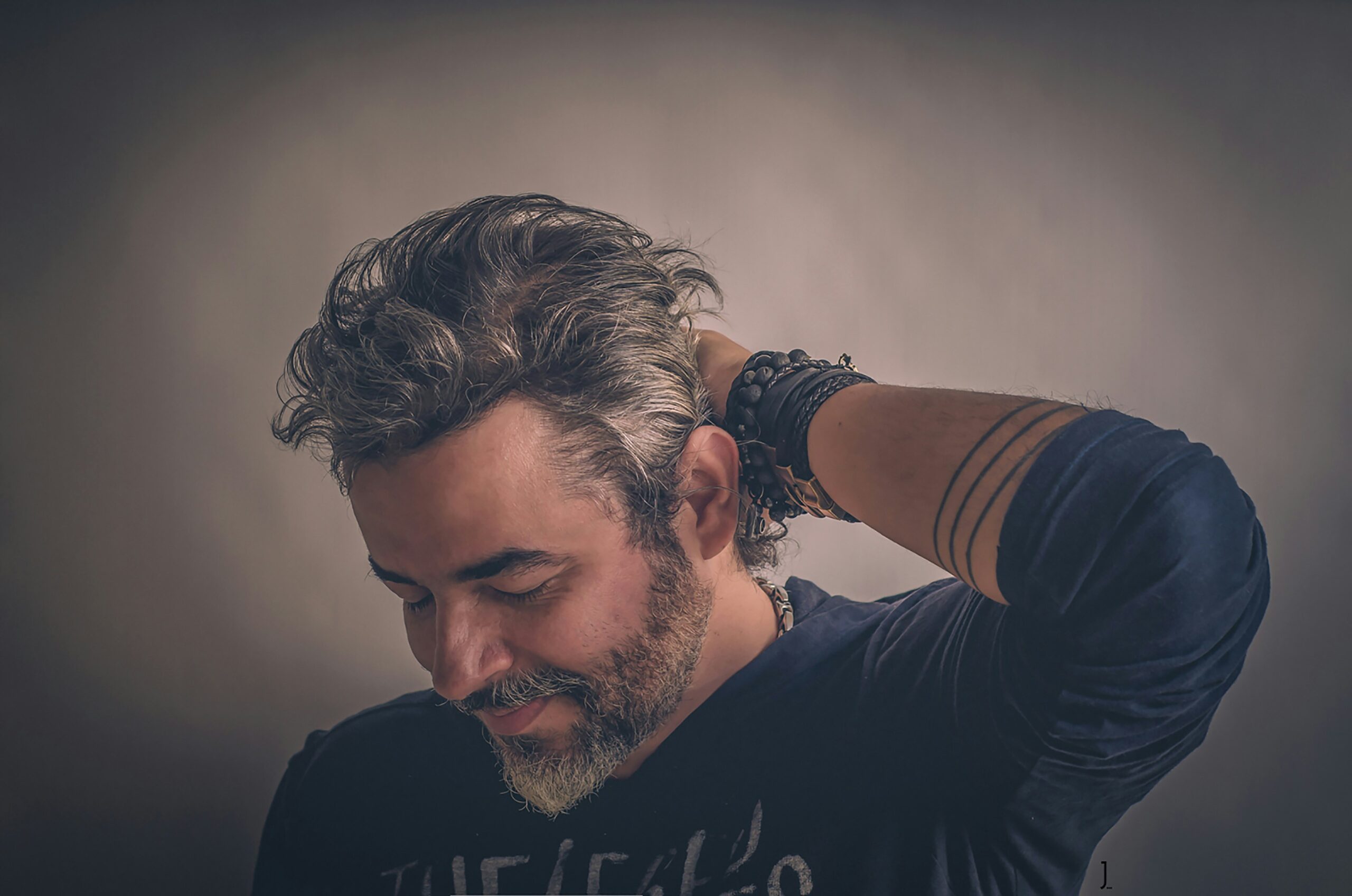 Protecting Your Hair After Restoration: Preventing Future Hair Loss